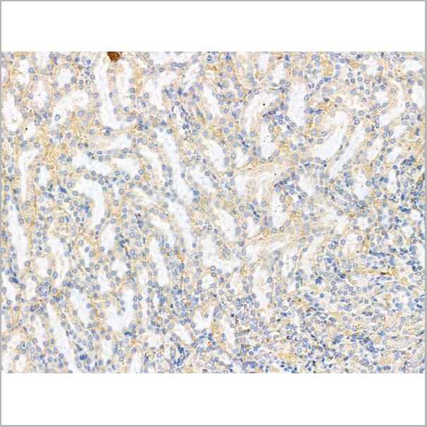 product-image-AAA31209_IHC4.jpg