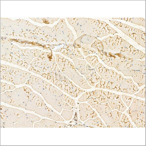product-image-AAA31209_IHC5.jpg