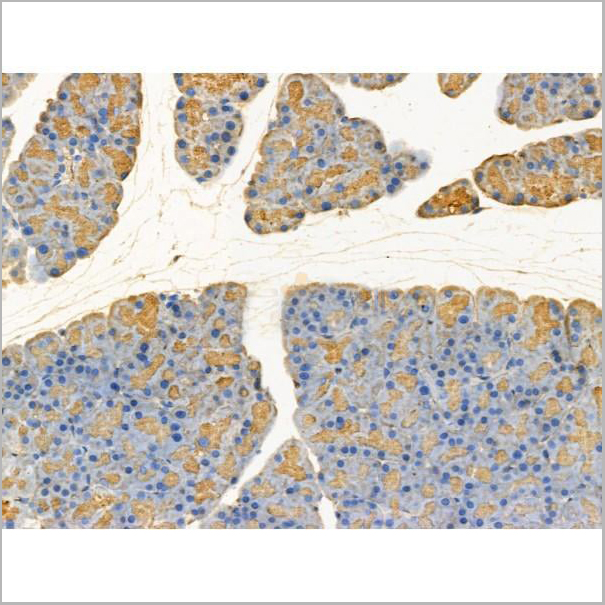 product-image-AAA31210_IHC2.jpg