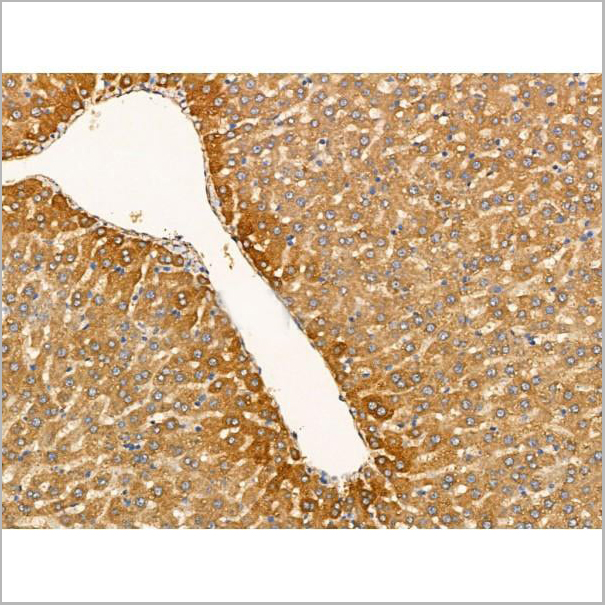 product-image-AAA31210_IHC3.jpg
