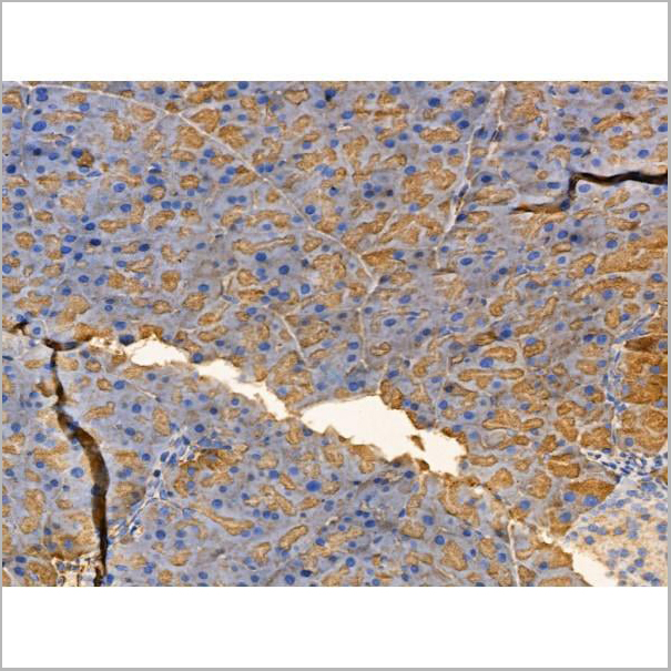 product-image-AAA31210_IHC4.jpg