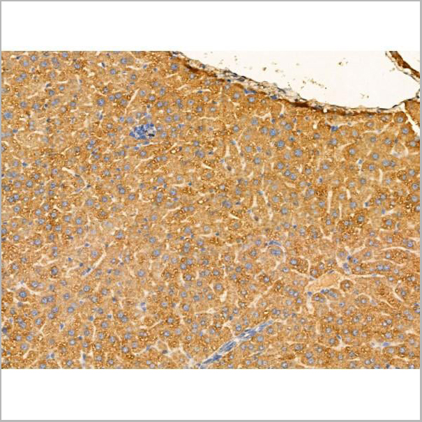 product-image-AAA31210_IHC5.jpg