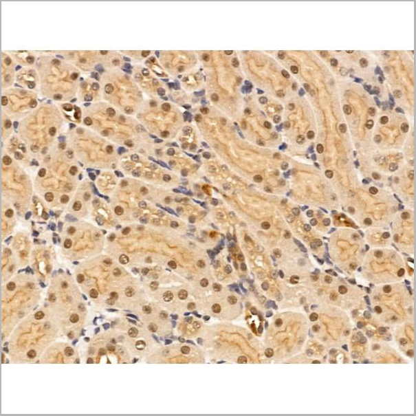 product-image-AAA31211_IHC3.jpg