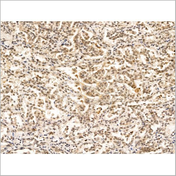 product-image-AAA31211_IHC4.jpg