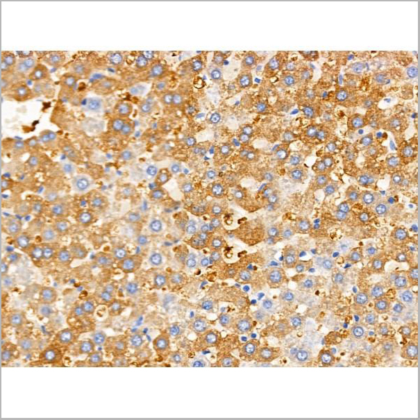 product-image-AAA31212_IHC2.jpg