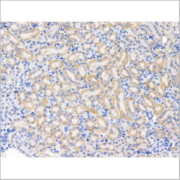 product-image-AAA31212_IHC4.jpg