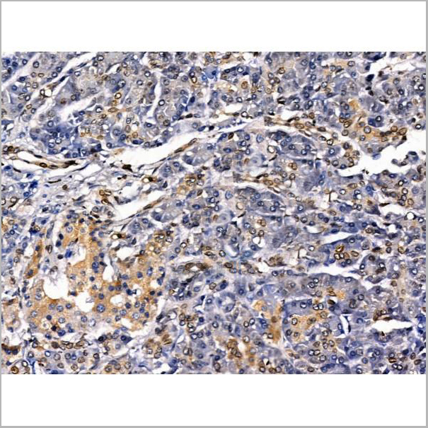 product-image-AAA31214_IHC6.jpg