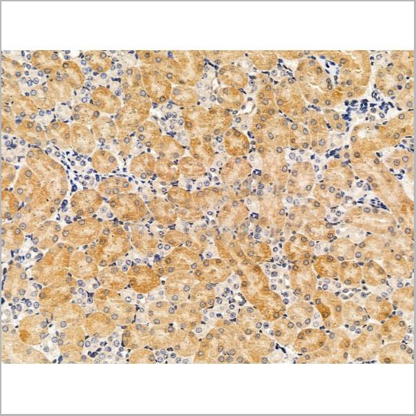 product-image-AAA31215_IHC3.jpg