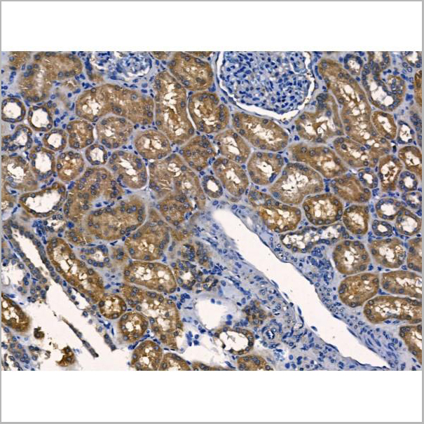 product-image-AAA31215_IHC7.jpg