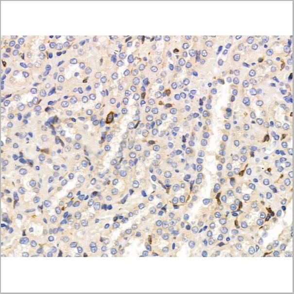 product-image-AAA31218_IHC3.jpg