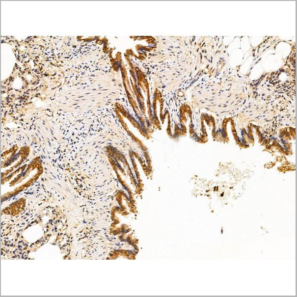 product-image-AAA31219_IHC2.jpg