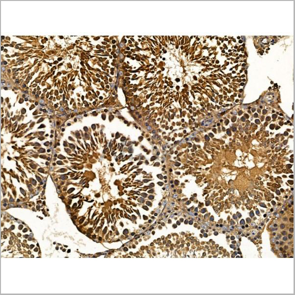 product-image-AAA31219_IHC6.jpg