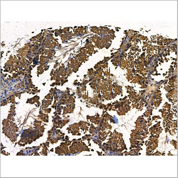 product-image-AAA31219_IHC7.jpg