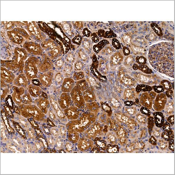 product-image-AAA31221_IHC6.jpg
