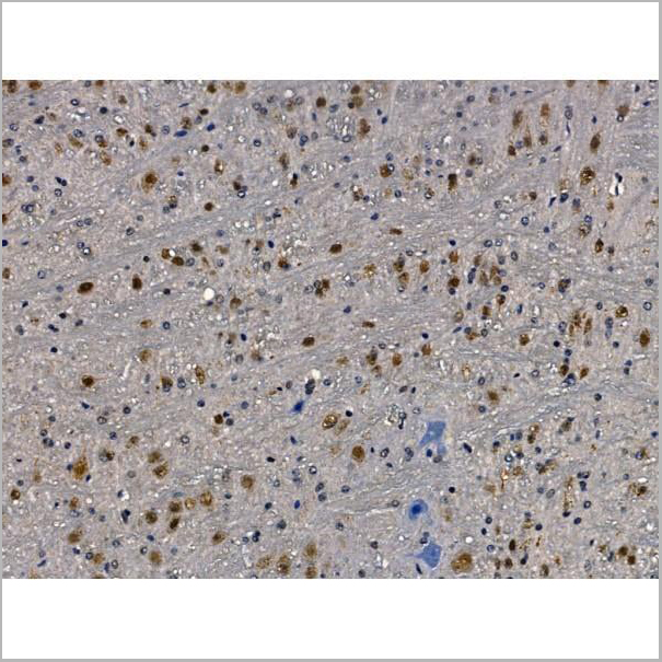product-image-AAA31222_IHC10.jpg