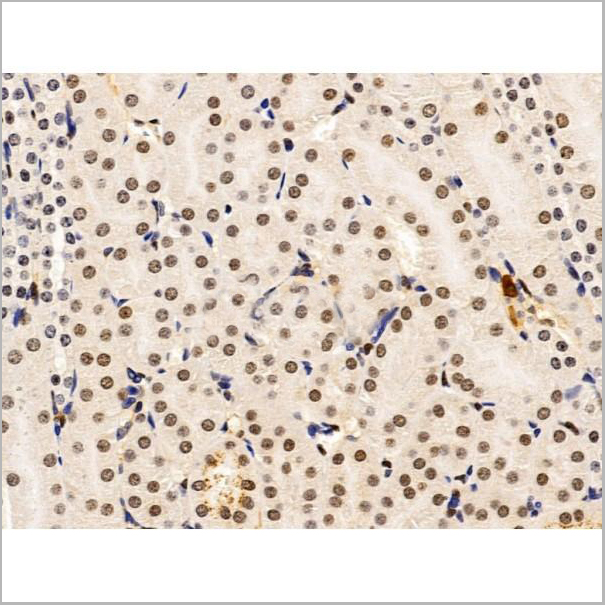 product-image-AAA31222_IHC4.jpg