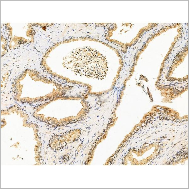 product-image-AAA31222_IHC5.jpg
