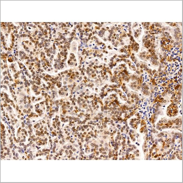 product-image-AAA31222_IHC6.jpg