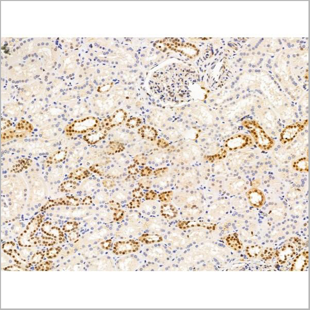 product-image-AAA31222_IHC8.jpg