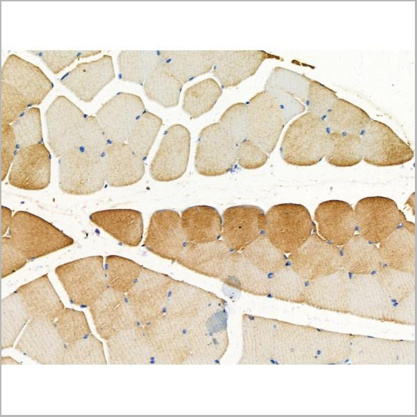 product-image-AAA31223_IHC2.jpg