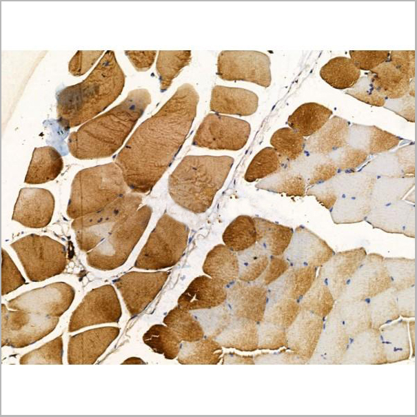 product-image-AAA31223_IHC5.jpg