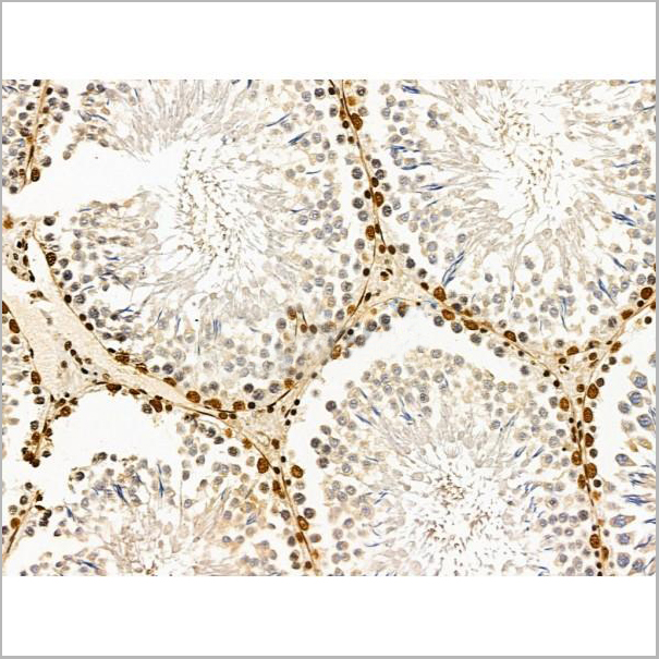 product-image-AAA31224_IHC2.jpg