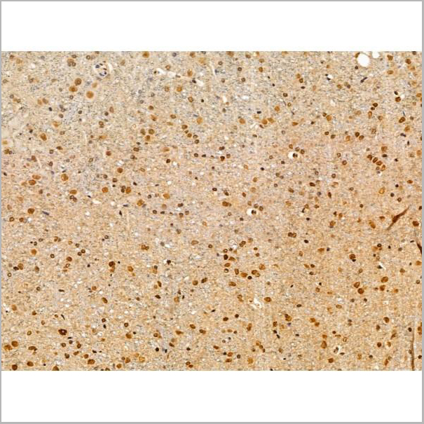 product-image-AAA31224_IHC5.jpg