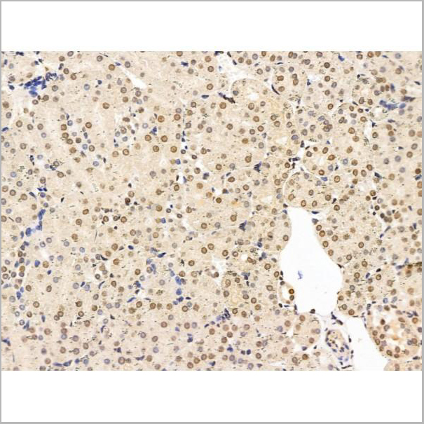 product-image-AAA31224_IHC6.jpg