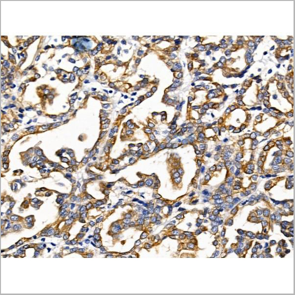 product-image-AAA31225_IHC4.jpg