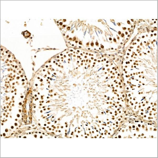 product-image-AAA31226_IHC2.jpg