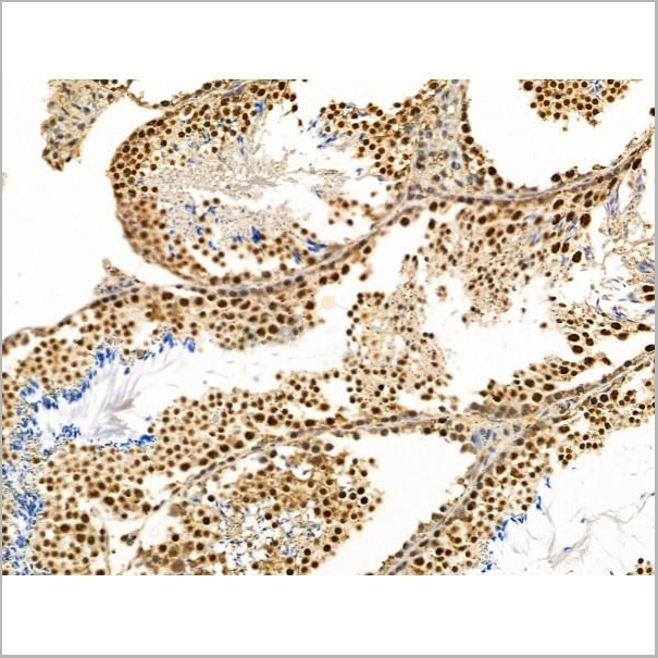 product-image-AAA31226_IHC3.jpg