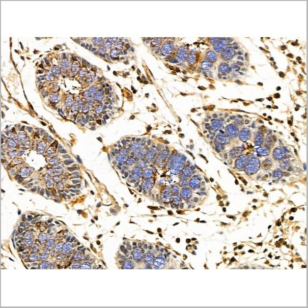product-image-AAA31226_IHC6.jpg