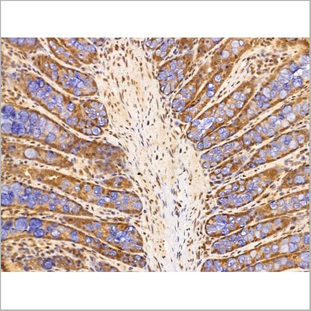 product-image-AAA31227_IHC2.jpg