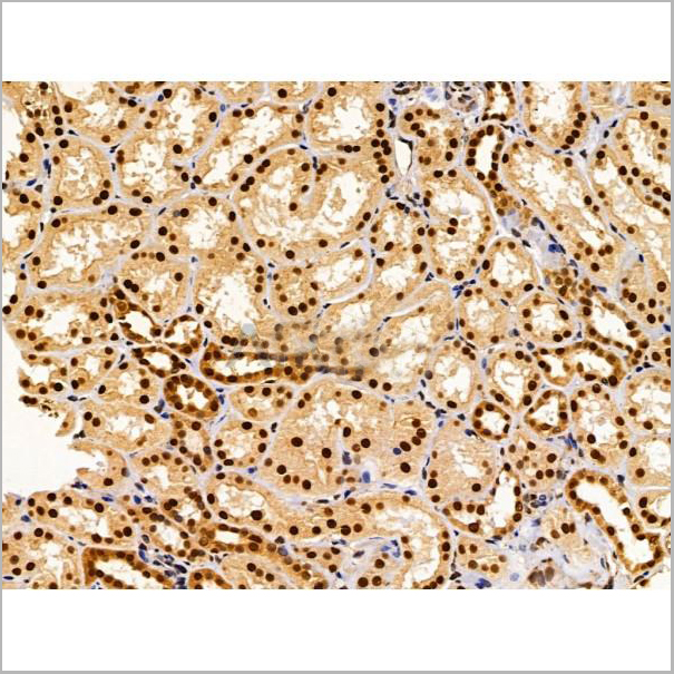 product-image-AAA31227_IHC3.jpg