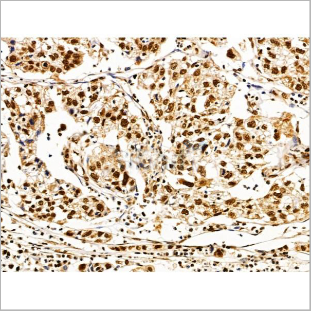 product-image-AAA31227_IHC4.jpg