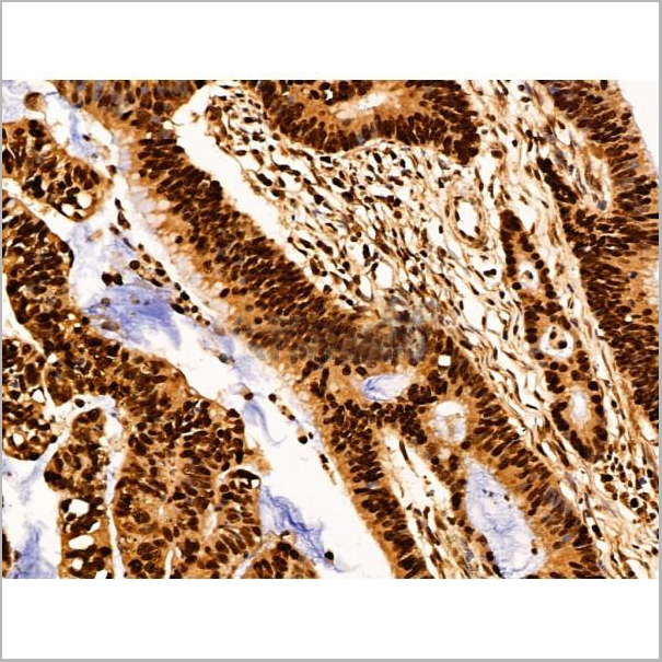 product-image-AAA31227_IHC5.jpg