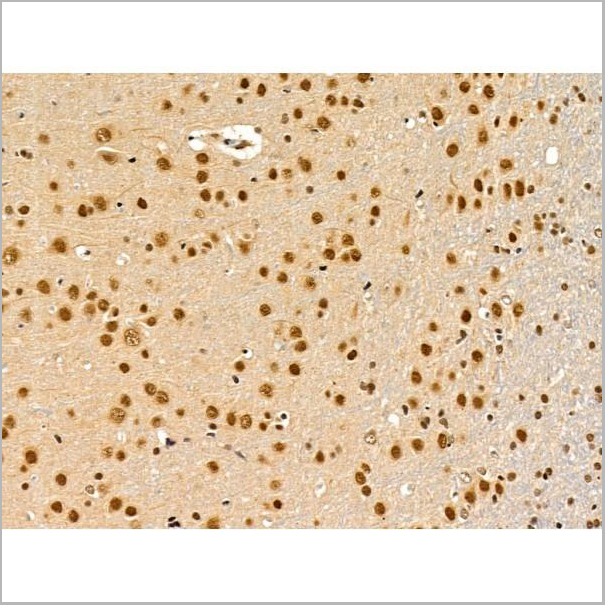 product-image-AAA31228_IHC2.jpg