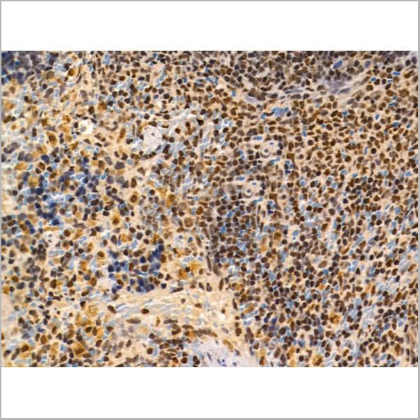 product-image-AAA31228_IHC3.jpg