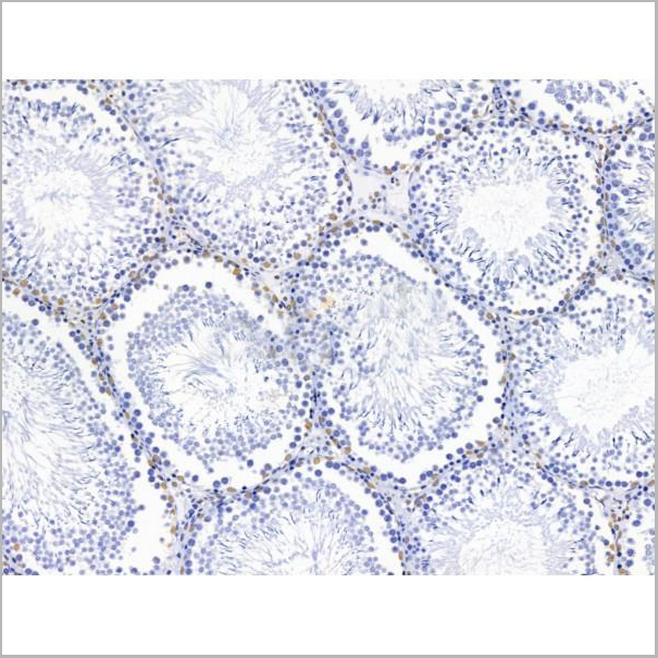 product-image-AAA31229_IHC3.jpg