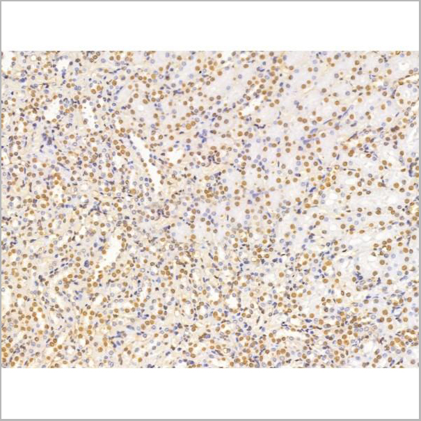product-image-AAA31229_IHC6.jpg