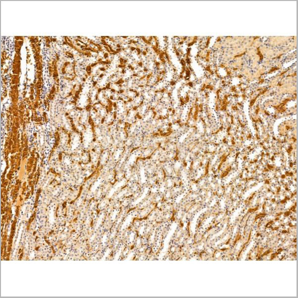 product-image-AAA31230_IHC4.jpg