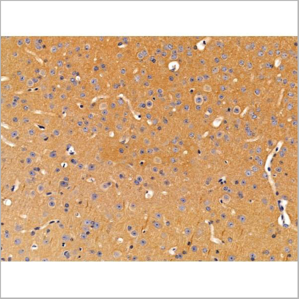 product-image-AAA31230_IHC5.jpg