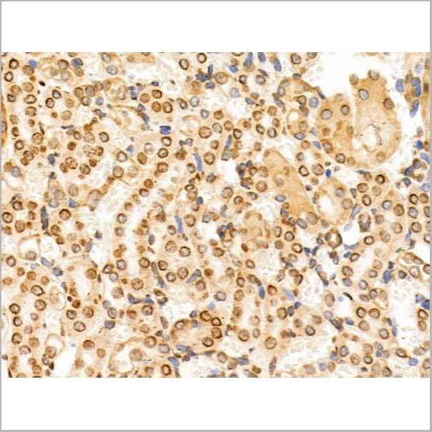 product-image-AAA31231_IHC4.jpg