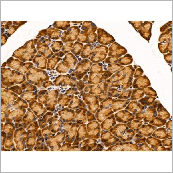 product-image-AAA31232_IHC2.jpg