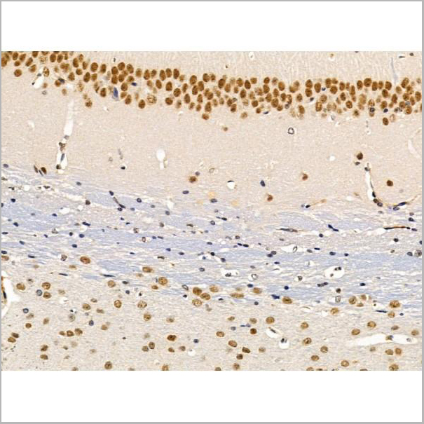 product-image-AAA31232_IHC5.jpg