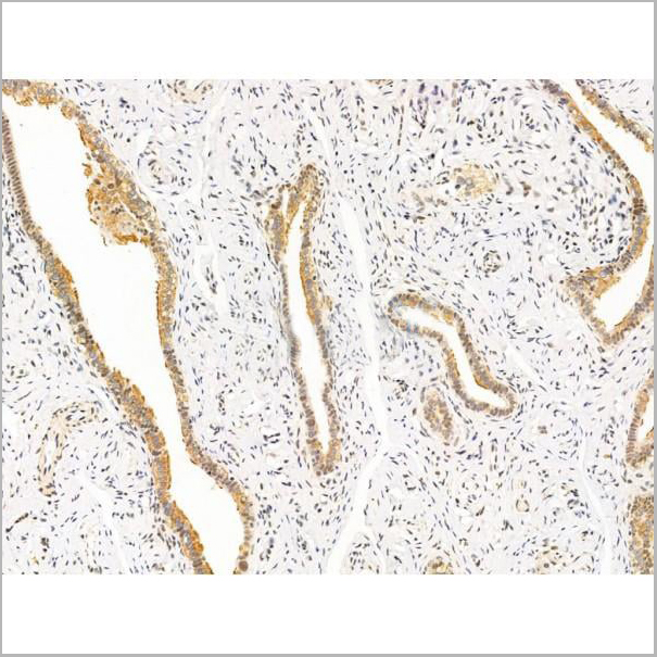 product-image-AAA31232_IHC6.jpg