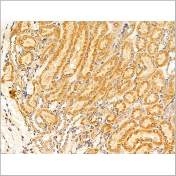 product-image-AAA31233_IHC2.jpg