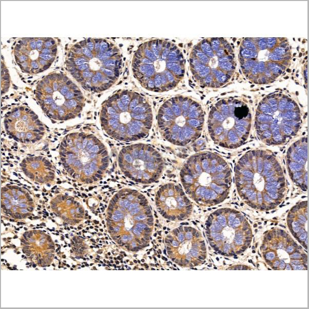 product-image-AAA31233_IHC5.jpg