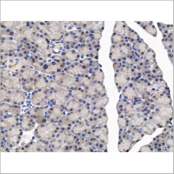 product-image-AAA31234_IHC2.jpg