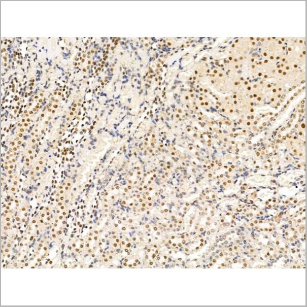 product-image-AAA31234_IHC3.jpg